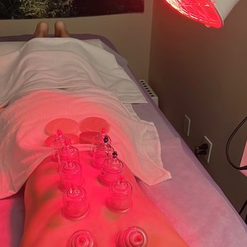 Inner Beauty Acu Clinic - Cupping, hot mineral stones, acupuncture, essential oils, targeted massages throughout treatment - Acupuncture Near Me - Tustin, California Inner Beauty Acu Clinic - Cupping, hot mineral stones, acupuncture, essential oils, targeted massages throughout treatment - Acupuncture Near Me - Tustin, California