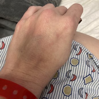 UPMC St. Margaret Emergency Department - Took blood from my hand - Orthopedists Near Me - Pittsburgh, Pennsylvania UPMC St. Margaret Emergency Department - Took blood from my hand - Orthopedists Near Me - Pittsburgh, Pennsylvania