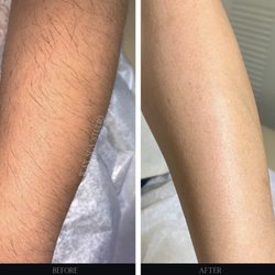 Wax Spa Studio - Arm wax