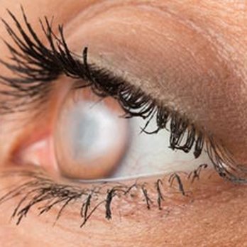 Joel B. Katcher Optometrist - Optometrists Near Me - Schaumburg, Illinois