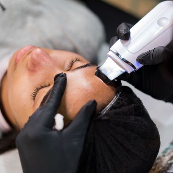 Holistic Esthetics & Restorative Care - Exfoliation - Skin Care Near Me Holistic Esthetics & Restorative Care - Exfoliation - Skin Care Near Me