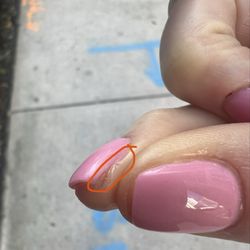 Trini Salon & Spa - This is the cut from the nail file. It isn't bleeding anymore due to her styptic gel, but you can see the actual cut.