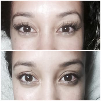 Honey Om Skin Spa & Lashes - Before and amazing after! - Skin Care Near Me - Seattle, Washington Honey Om Skin Spa & Lashes - Before and amazing after! - Skin Care Near Me - Seattle, Washington