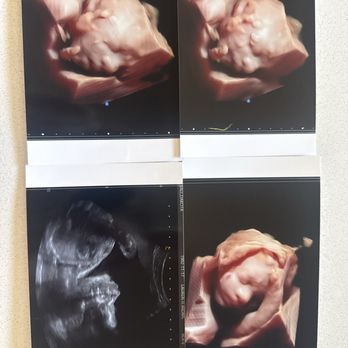 Heart And Hand Imaging - 3D ultrasound - Diagnostic Imaging Near Me - Star, Idaho Heart And Hand Imaging - 3D ultrasound - Diagnostic Imaging Near Me - Star, Idaho