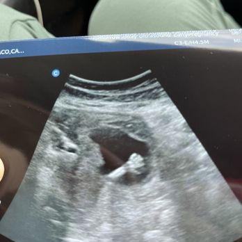 TomorrowToday Ultrasound - Ultrasound Imaging Centers Near Me - Aiea, Hawaii TomorrowToday Ultrasound - Ultrasound Imaging Centers Near Me - Aiea, Hawaii