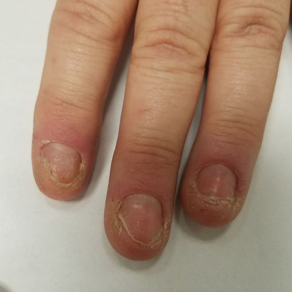 First Nails - Nail Salons Near Me - Ukiah, California First Nails - Nail Salons Near Me - Ukiah, California