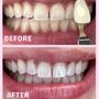 Photo of Cute Tooth