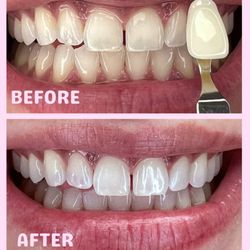 Cute Tooth - 30 min touch up