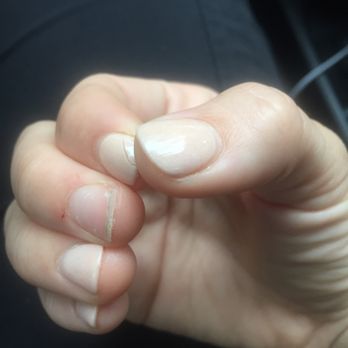 Bluegrass Milton - Cracked nail and SNS fell off. - Nail Salons Near Me - Alpharetta, Georgia