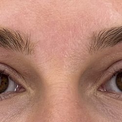 Cassidy's Nail & Spa - Burn on both eyebrows from waxing
