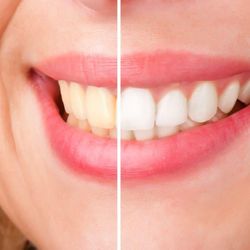Eagle Rock Dental Care