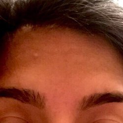 After threading