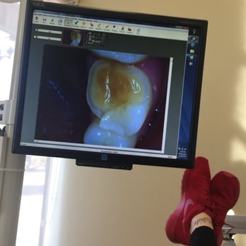 Markham Luminita, DDS - Broken tooth due to incorrect procedure - Orthodontists Near Me - Auburn, California