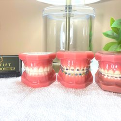 Baptist Orthodontics - Did you know that there are multiple treatment options to straighten your teeth? Lets discuss your options at your complimentary consult!
