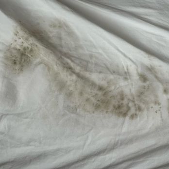 The Pearl Hotel - Dirty pillowcase with black mold - San Diego, CA
