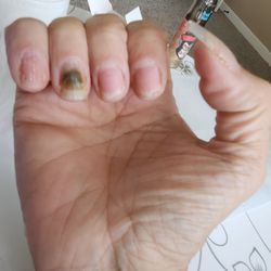Art Nails and Spa - Black fungus