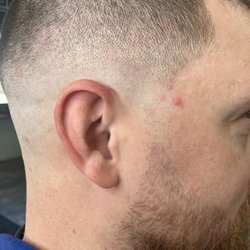 Skin fade