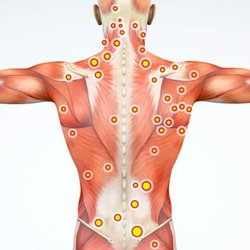 Taiji Rubbing - Trigger point.