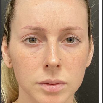 Med Lounge - Their "results". Put in a photoshop detector and detected modifications. - Skin Care Near Me - Ladera Ranch, California Med Lounge - Their "results". Put in a photoshop detector and detected modifications. - Skin Care Near Me - Ladera Ranch, California