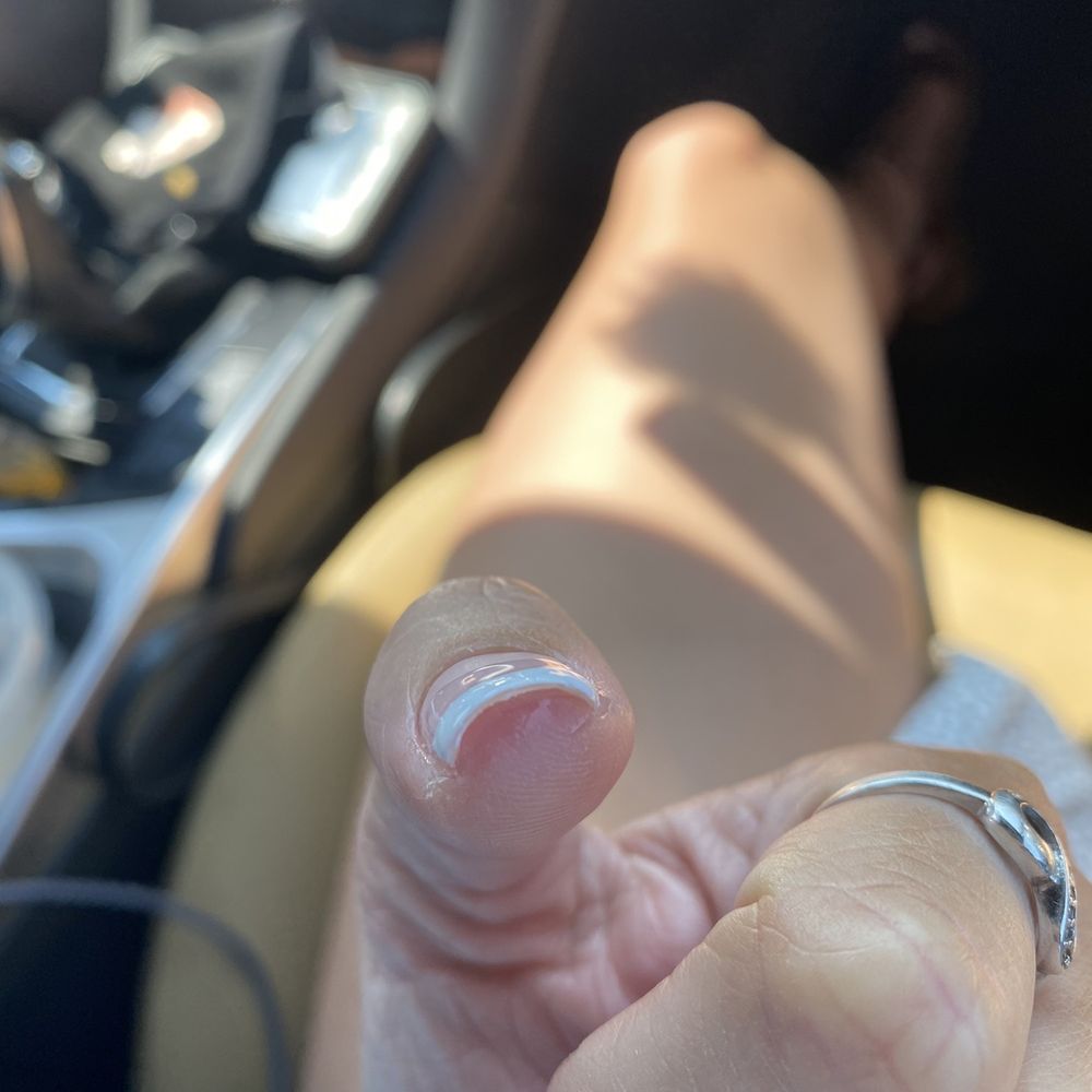 didn't clean up the skin around my nails didn't clean up the skin around my nails