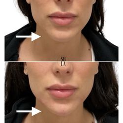 Skinblvd