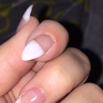 Nail Bar - Only two days old and still swollen - Nail Salons Near Me - Menifee, California