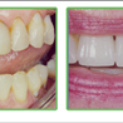 Sam English, DDS