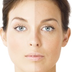 Balm & Bubble: medspa + wellness - Whitening - Brightening
