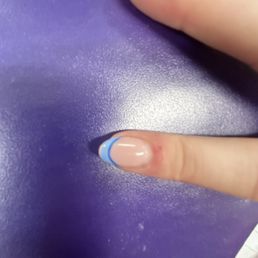 Chipped gel
