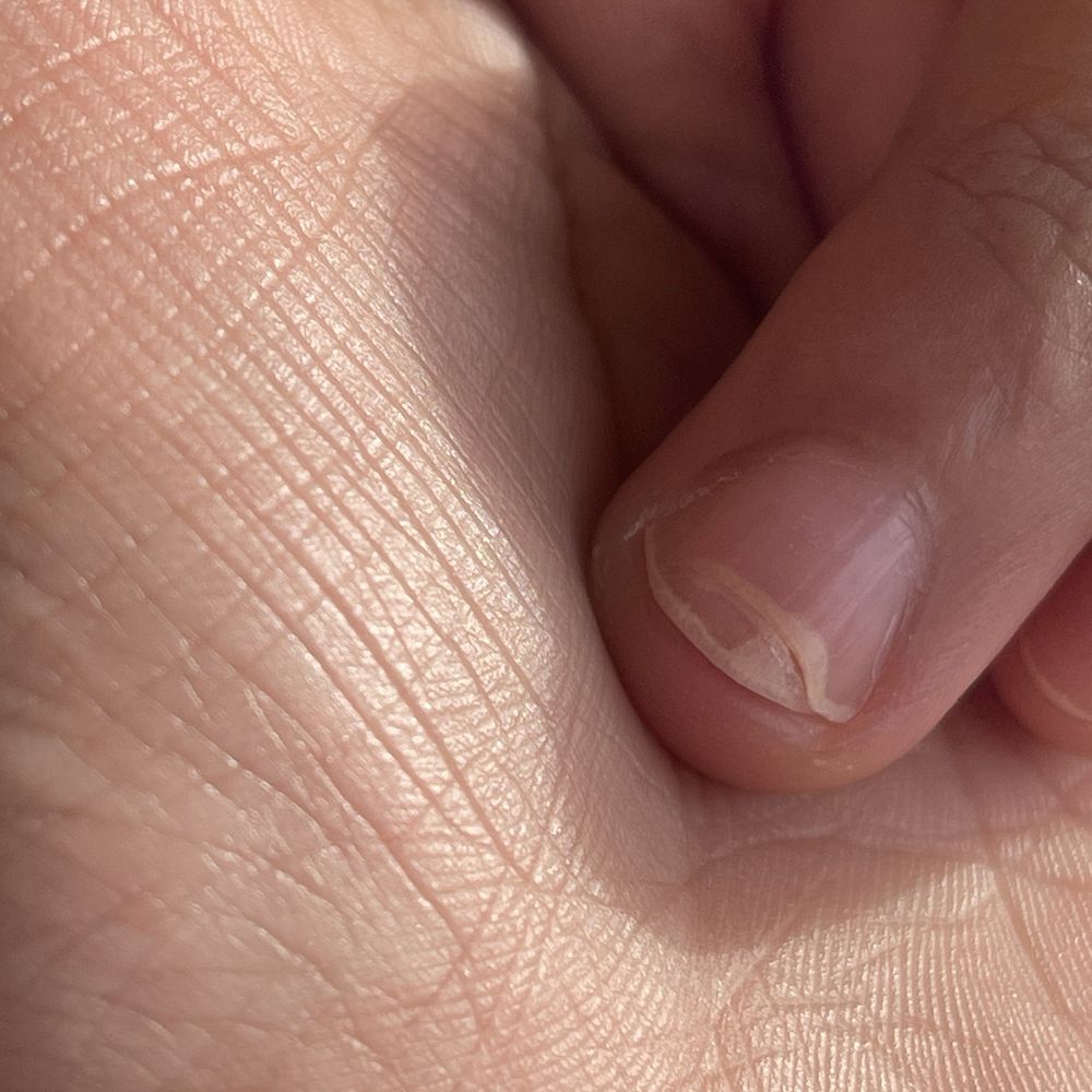 9194 Nail Lounge - Chipped nail. - Nail Salons Near Me - San Antonio, Texas 9194 Nail Lounge - Chipped nail. - Nail Salons Near Me - San Antonio, Texas