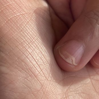 9194 Nail Lounge - Chipped nail. - Nail Salons Near Me - San Antonio, Texas 9194 Nail Lounge - Chipped nail. - Nail Salons Near Me - San Antonio, Texas
