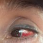 Keeble Eye Care