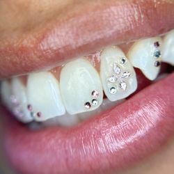 Ice My Pearls Tooth Gems
