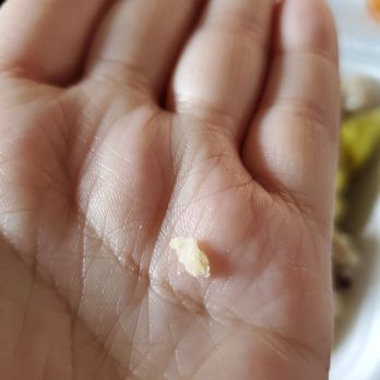 The Dim Sum - Piece of bone in my Pork & Shrimp Xiu Mai :( - Dim Sum Near Me - Westminster, California The Dim Sum - Piece of bone in my Pork & Shrimp Xiu Mai :( - Dim Sum Near Me - Westminster, California