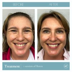 Wesley Chapel Laser and Aesthetics