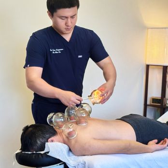 Sun-Ease Acupuncture - Cupping therapy - Acupuncture Near Me - Derwood, Maryland Sun-Ease Acupuncture - Cupping therapy - Acupuncture Near Me - Derwood, Maryland