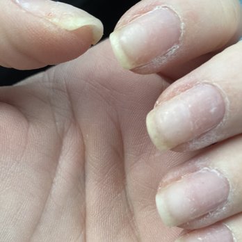 Poshe Salon & Spa - You can see the builder still on the nails and how rough they are. Red nail polish would have looked horrible on these. - Skin Care Near Me - Middletown, Ohio Poshe Salon & Spa - You can see the builder still on the nails and how rough they are. Red nail polish would have looked horrible on these. - Skin Care Near Me - Middletown, Ohio