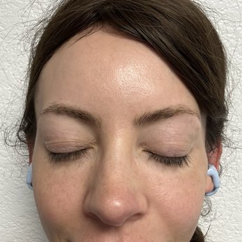 Laser Fresh Aesthetics - Tattoo Removal Near Me - Santa Rosa, California Laser Fresh Aesthetics - Tattoo Removal Near Me - Santa Rosa, California