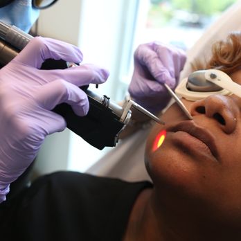 WIFH - Laser Hair Removal Near Me - Atlanta, Georgia WIFH - Laser Hair Removal Near Me - Atlanta, Georgia