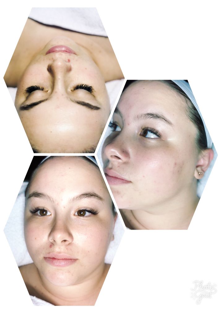Skin Plus Logo