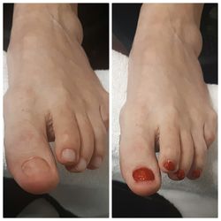 Sandstone Beauty - Toenail Reconstruction