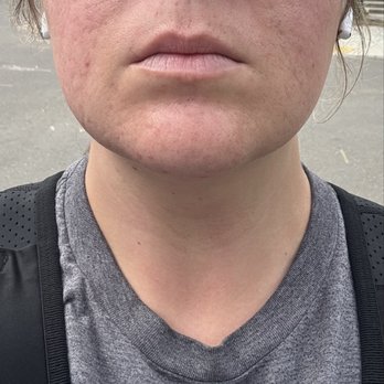 Facial Kneads By Mari - After - Skin Care Near Me - San Jose, California