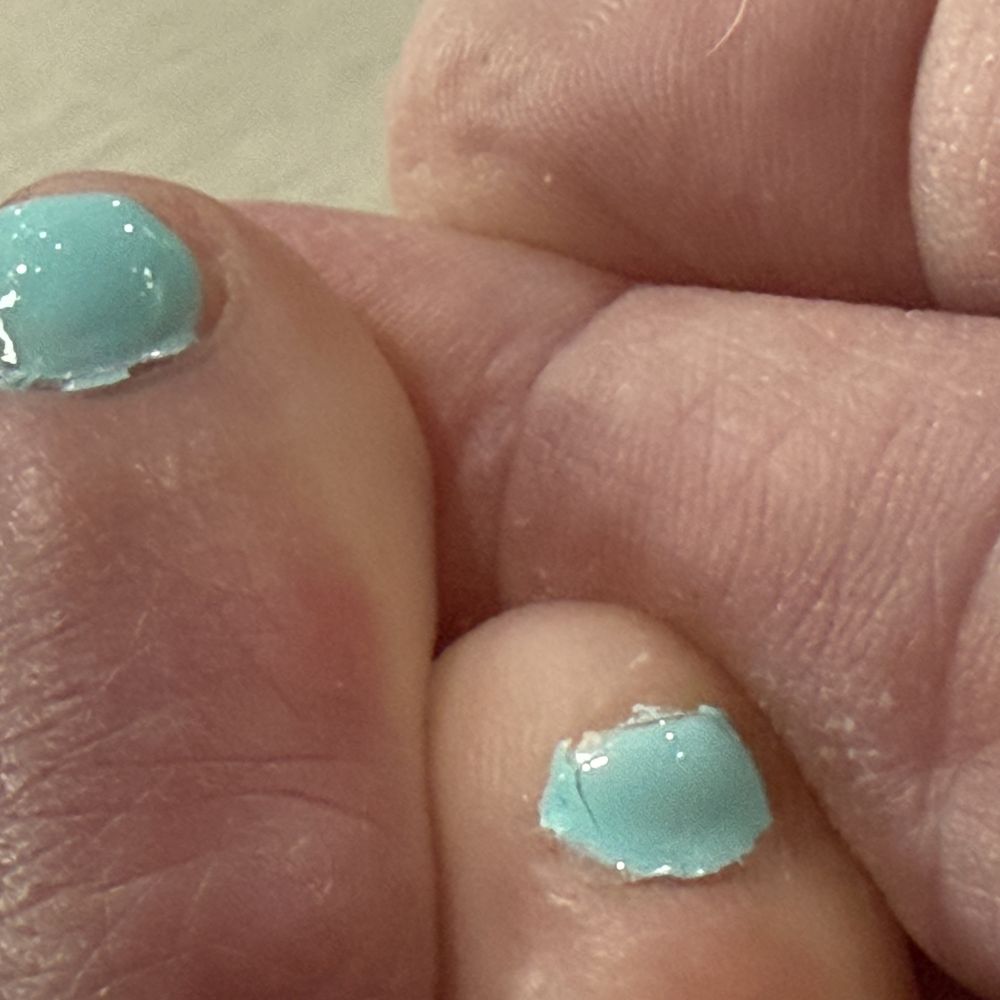 Fidalgo Nails - Right two small toes - Nail Salons Near Me - Anacortes, Washington Fidalgo Nails - Right two small toes - Nail Salons Near Me - Anacortes, Washington