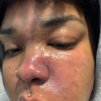 First Street Tattoo and Piercing Studio - My face is swollen and rough. - Tattoo Near Me - Humble, Texas