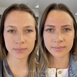 Natural Beauty LA