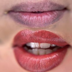 LA Beauty PMU by Stacey Corletto - Lip blush neutralization before and fresh after