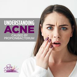 Understanding Acne Caused by Propionibacterium