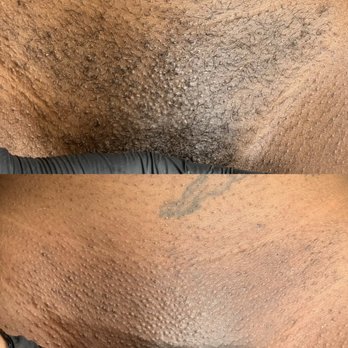 Waxed Luxury Wax Lounge - We use a 100% vegan-hypoallergenic hard wax. - Waxing Near Me - Houston, Texas Waxed Luxury Wax Lounge - We use a 100% vegan-hypoallergenic hard wax. - Waxing Near Me - Houston, Texas