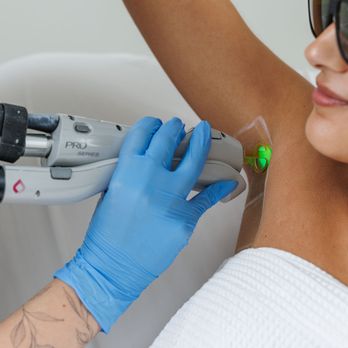 Milan Laser Hair Removal - Laser Hair Removal Near Me - Appleton, Wisconsin Milan Laser Hair Removal - Laser Hair Removal Near Me - Appleton, Wisconsin