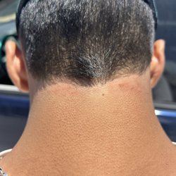 Ace Of Fadez - Irritated skin and cuts
